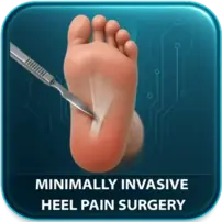 Plantar Fasciotomy