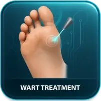 Wart Treatment