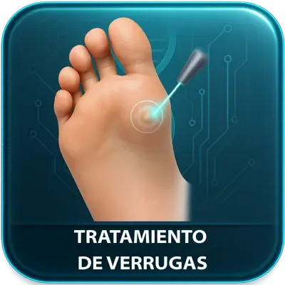 Tratamiento de Verrugas
